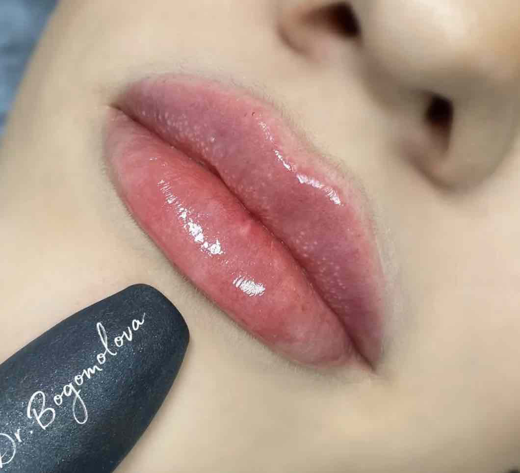 Konturna-plastyka-gub-lviv