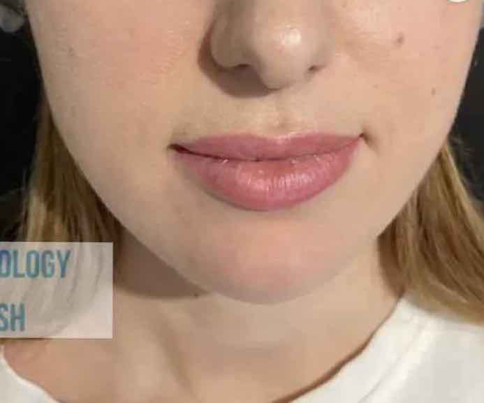 Konturna-plastyka-pidboriddya-Lviv-1