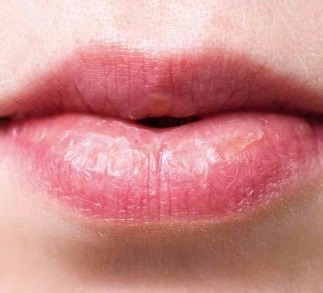 Vyrivnuvannya-asymetrii-gub